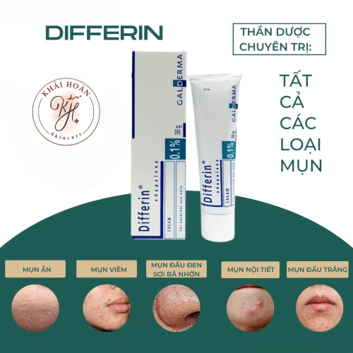 Gel Giảm mụn, thâm GALDERMA Differine Adapalene 0.1% - 30g 2