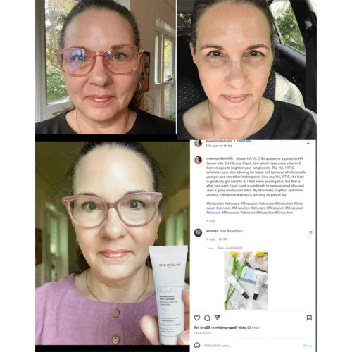 Serum Phục Hồi Sáng Da 97% HA Miraculum Woda Termalna 7