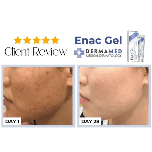 Gel giảm thâm mụn Enac Gel 2