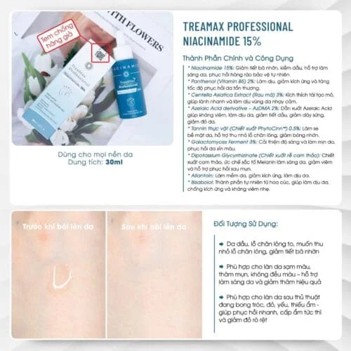 Serum Treamax Niacinamide 15%| Cứu Tinh Cho Da Dầu Mụn, Thâm 1