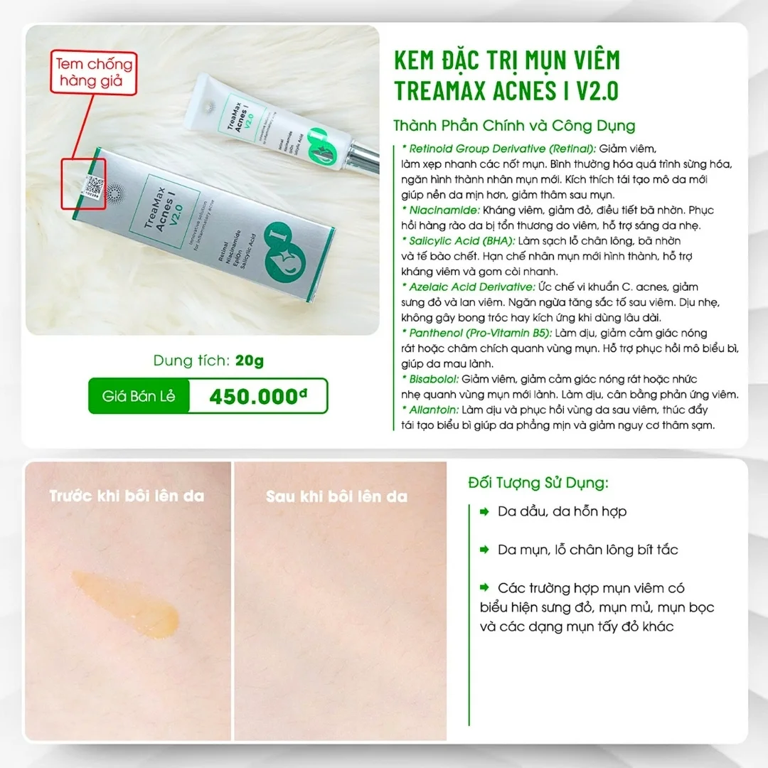 Treamax Acnes V2.0 1