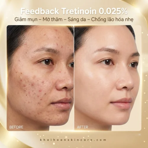 Taro Tretinoin 0.025 USP 1