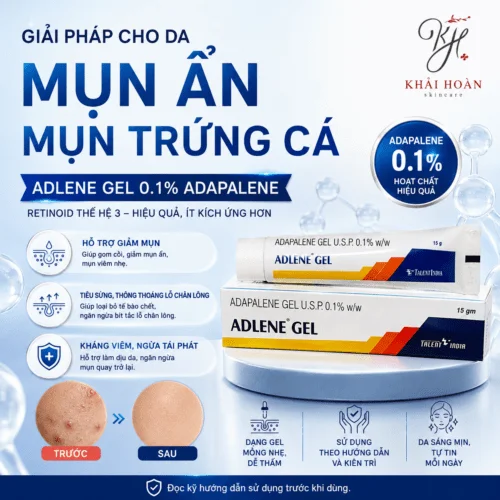Adlene Gel 0.1% Adapalene - Kem Bôi Giảm Mụn, Tiêu Sừng (15g)