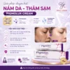 Pigmolux Cream 15g - Kem Bôi Giảm Nám, Tàn Nhang