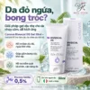 Canova Rivescal DS Gel 50ml Hỗ Trợ Da Viêm Da Tiết Bã, Giảm Đỏ Ngứa Và Bong Tróc